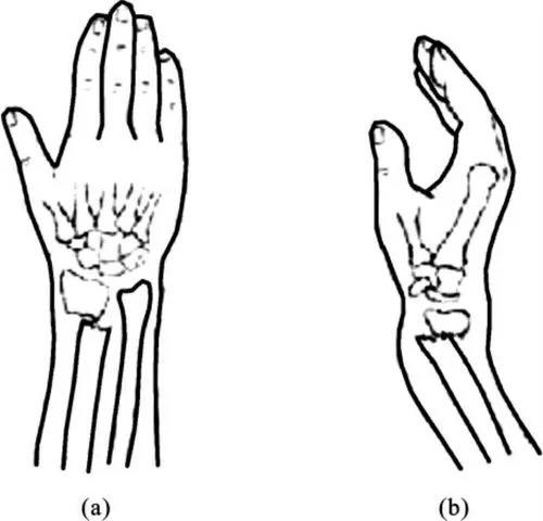 C:\Users\fengfeng\AppData\Local\Temp\WeChat Files\1d8d75ced55706c9c78b4f202017bc3.jpg