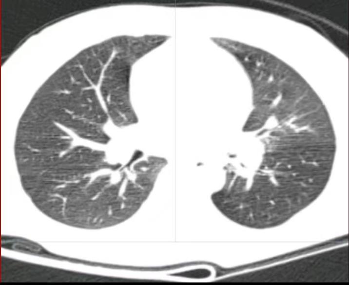 6ce4651aeda4776315a0131f797e11a