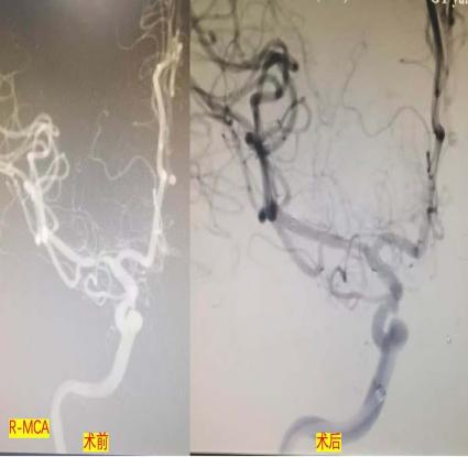 cd8b8cadc0612f372f539702c2ef28f