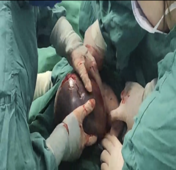 76e9aa2e657f8ef03ac31a8cf097014