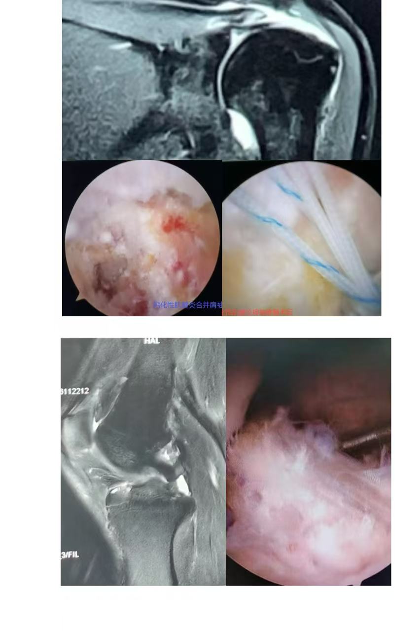 42770d800d3a497dfa6850c6723ea1d